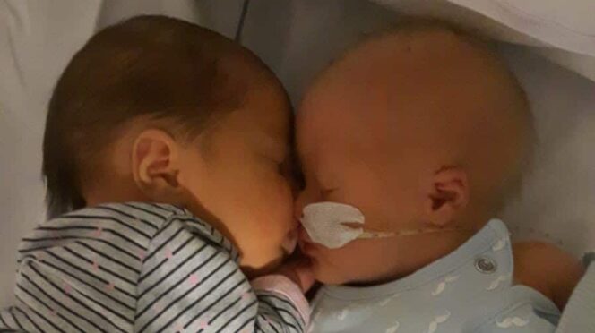 kind, baby, syndroom van down