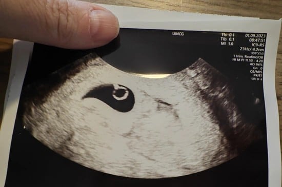 baarmoeder, foto, baby