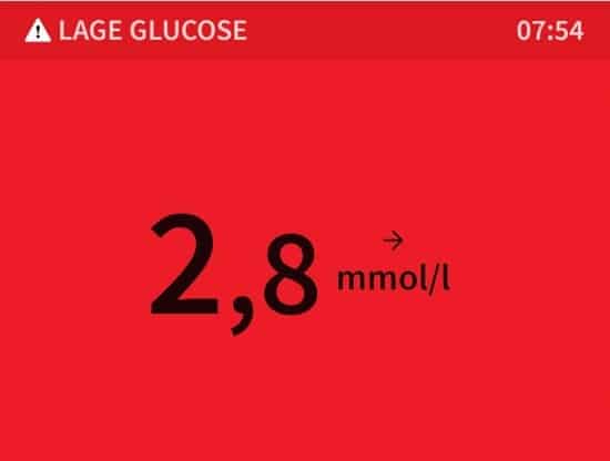 diabetes, zwanger
