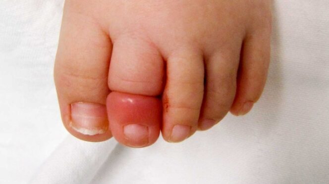 De-Spoedzusters-Mamaplaats Experts De ontroostbare baby haar teen pijn