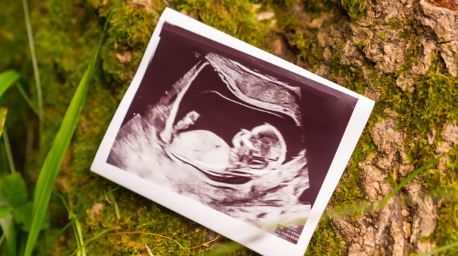 Mamaplaats-persoonlijk-verhaal-Macrosomie-een-te-zware-baby-2 echo foto gras