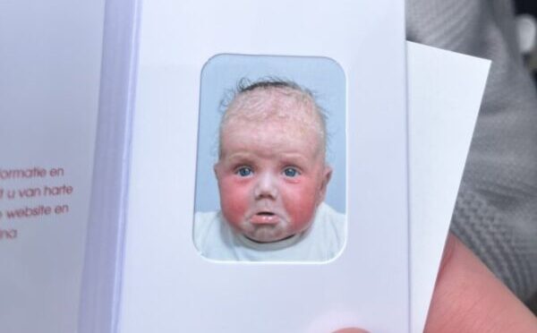 baby exceem koemelkallergie pasfoto