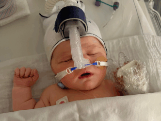 bevallingsverhaal baby zuurstof