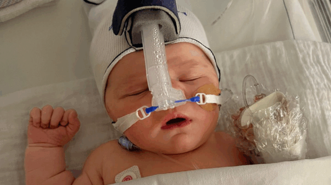 bevallingsverhaal baby zuurstof