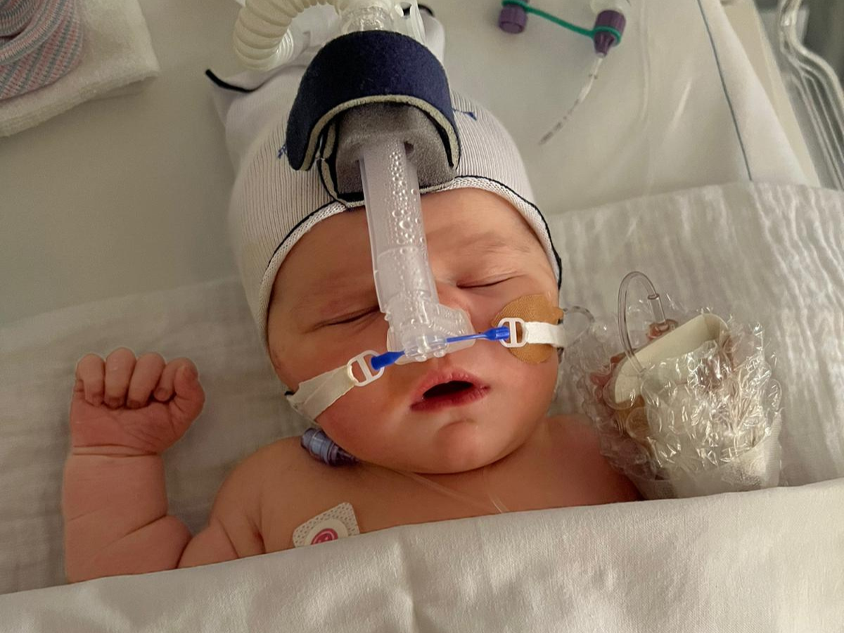 bevallingsverhaal baby zuurstof