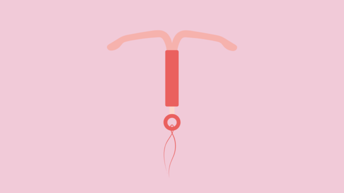 spiraaltje laten verwijderen