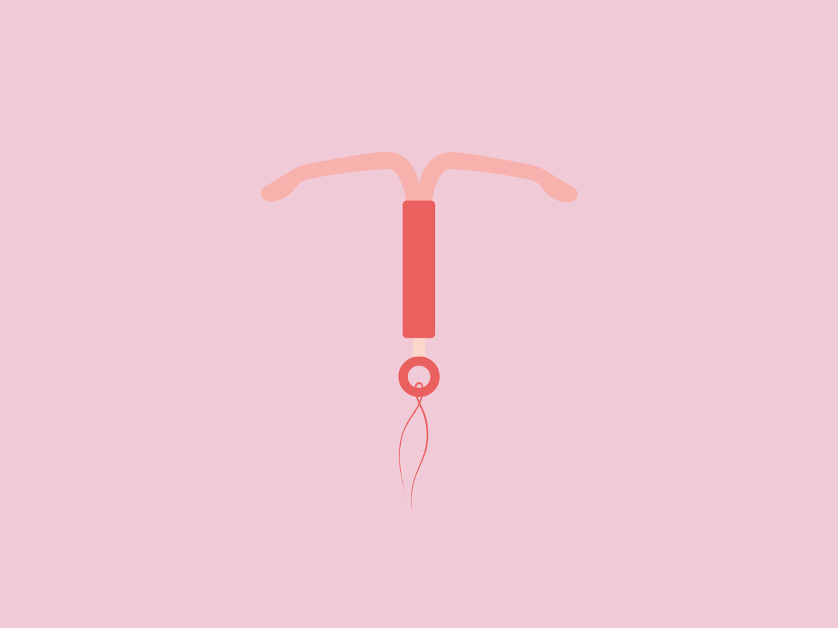 spiraaltje laten verwijderen