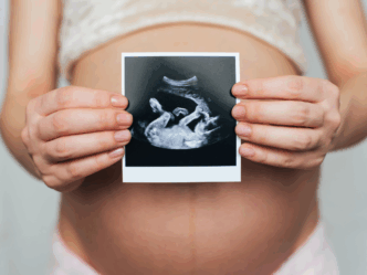 donkere streep buik zwanger