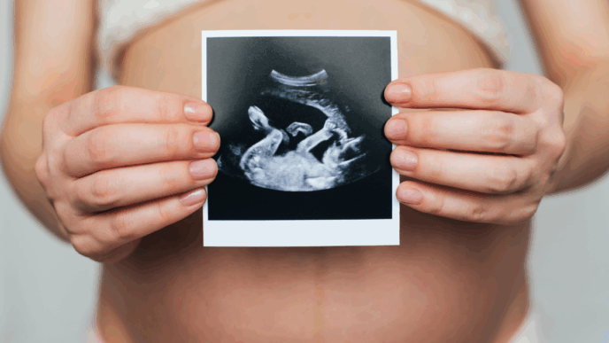 donkere streep buik zwanger