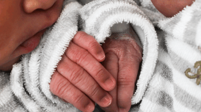 Siamese tweeling gescheiden