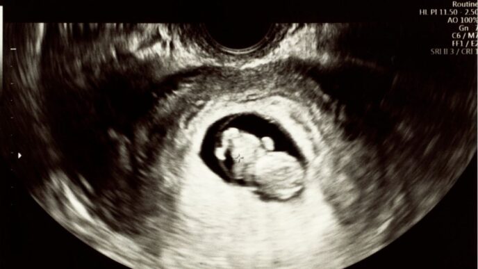 baby gapen in buik moeder foto van een echo