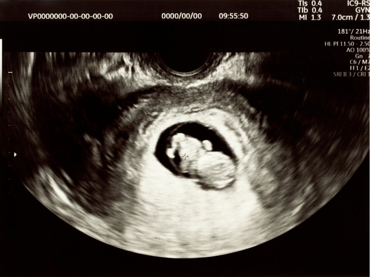 baby gapen in buik moeder foto van een echo