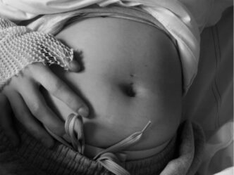 anencefalie baby foto van zwangere buik van karlijn